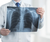 Incredible Results with the O2LungTrainer!